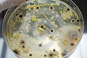 Colonies of different bacteria and molds