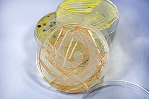 Colonies of different bacteria and molds