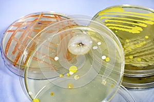 Colonies of different bacteria and molds