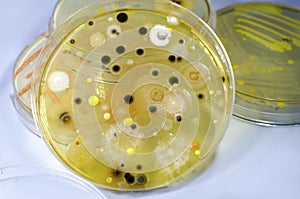 Colonies of different bacteria and molds