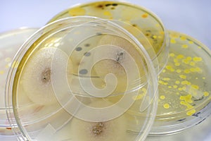 Colonies of different bacteria and molds
