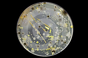 Colonies of different bacteria and molds photo