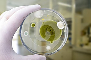 Colonies of different mold fungi grown from indoor air