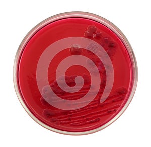 Colonies of Escherichia coli bacteria on red agar petri plate photo