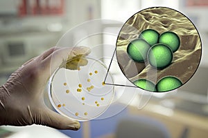 Colonies of Micrococcus luteus bacteria on agar plate