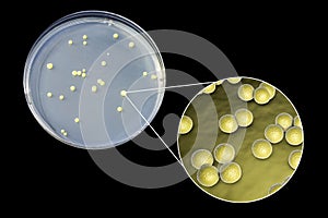 Colonies of Micrococcus luteus bacteria on agar plate photo