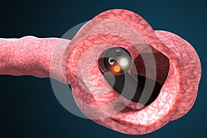 Colonoscopy and gastroscopy device