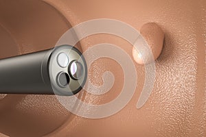 Colonoscopy technology concept