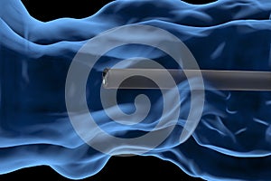 Colonoscopy technology concept