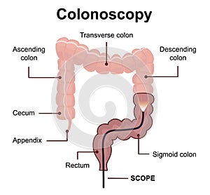 Colonoscopy technology concept with rendering endoscope inside of intestine