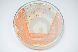 Colony of bacteria in culture medium plate.