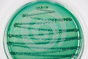 Colony of bacteria in culture medium plate.