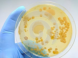 Colony of bacteria in culture medium plate