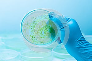 Colony of blue green algae in culture medium plate