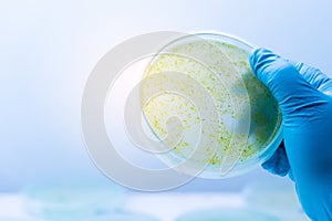 Colony of blue green algae in culture medium plate