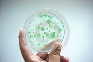 Colony of blue green algae in culture medium plate. photo