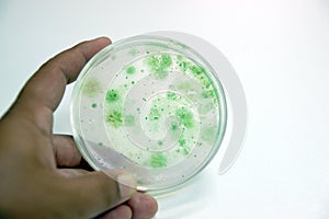 Colony of blue green algae in culture medium plate