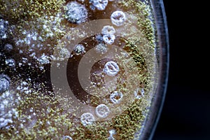 Characteristic of Actinomyces, Bacteria, yeast and Mold on selective media from soil samples for study in laboratory microbiology.