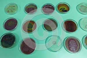 Colony Characteristics of Bacteria in petri dish for education.