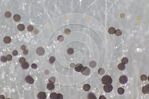 Colony Characteristics of Fungus Rhizopus in petri dish for education.