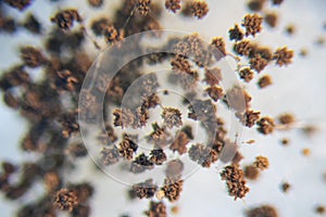Colony Characteristics of Rhizopus bread mold is a genus of common saprophytic fungi, Rhizopus bread mold.