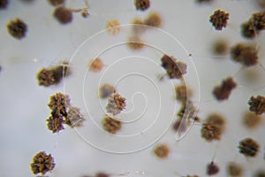 Colony Characteristics of Rhizopus bread mold is a genus of common saprophytic fungi, Rhizopus bread mold.