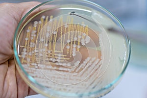 Colony Characteristics of Yeast in petri dish.