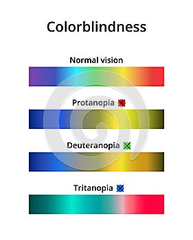 Color blindness or colorblindness. Normal vision, protanopia, tritanopia and deuteranopia. Color vision deficiency spectrum.