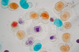 Pollen grains of different species under the microscope