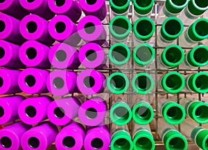 Colorful background a rack of color tubes for blood samples other patients .