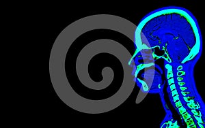 colorful of CT angiography of the brain or CTA brain  Sagittal view . Clipping path