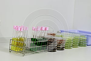 Colorful fluid culture medium in petri dish and test tube glassware with growing cultures of microorganisms on the table,