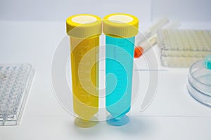 Colorful laboratory test tubes, biochemistry blood tests, urine test, tests tube, medical analysis, research concept, fertility r