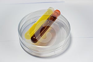 Colorful laboratory test tubes, biochemistry blood tests, urine test, tests tube, medical analysis, research concept, fertility r