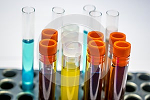 Colorful laboratory test tubes, biochemistry blood tests, urine test, tests tube, medical analysis, research concept, fertility r