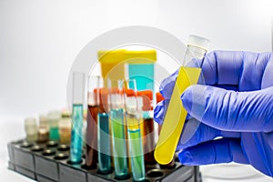 Colorful laboratory test tubes, biochemistry blood tests, urine test, tests tube, medical analysis, research concept, fertility r