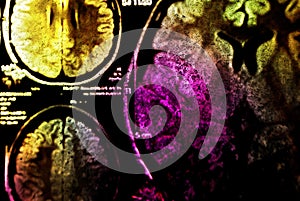 Colorful MRI of brain
