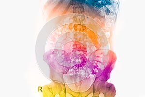 Colorful pelvic and spinal coloum x-rays image