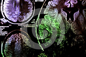 Colorful x-ray scan of brain