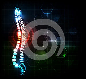 Backache concept, human spine photo