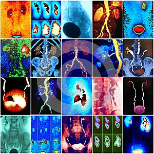 Colorful urological  diagnostic  imaging collage