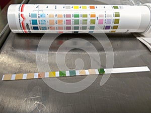 Colorimetric pH test. Laboratory test and medical testing