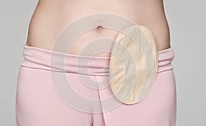 Colostomy pouch attached to patient - image