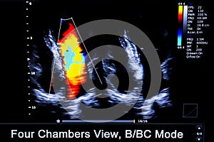 Colourful image of homan heart ultrasound monitor