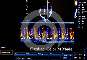 Colourful ultrasound monitor image. Cardiac