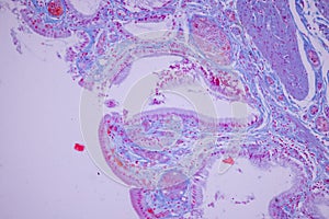 Columnar epithelium of human gall bladder under the microscope in Lab.