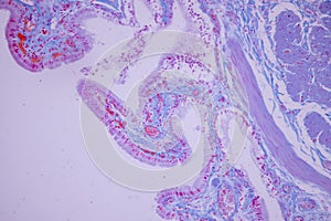 Columnar epithelium of human gall bladder under the microscope in Lab.