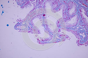 Columnar epithelium of human gall bladder under the microscope in Lab.