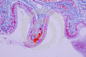 Columnar epithelium of human gall bladder under the microscope in Lab.