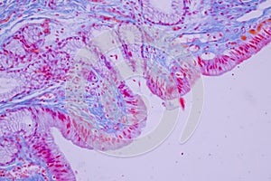 Columnar epithelium of human gall bladder under the microscope in Lab.